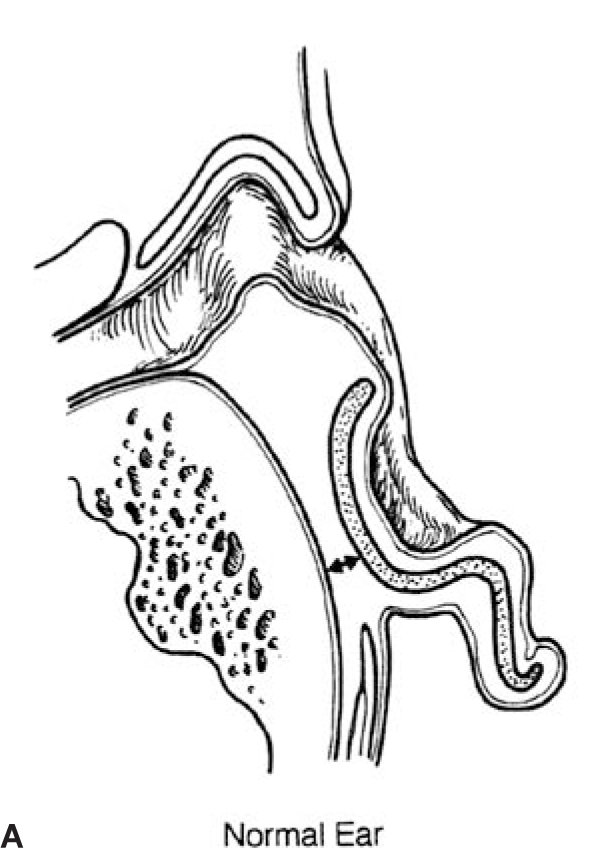 normal ear